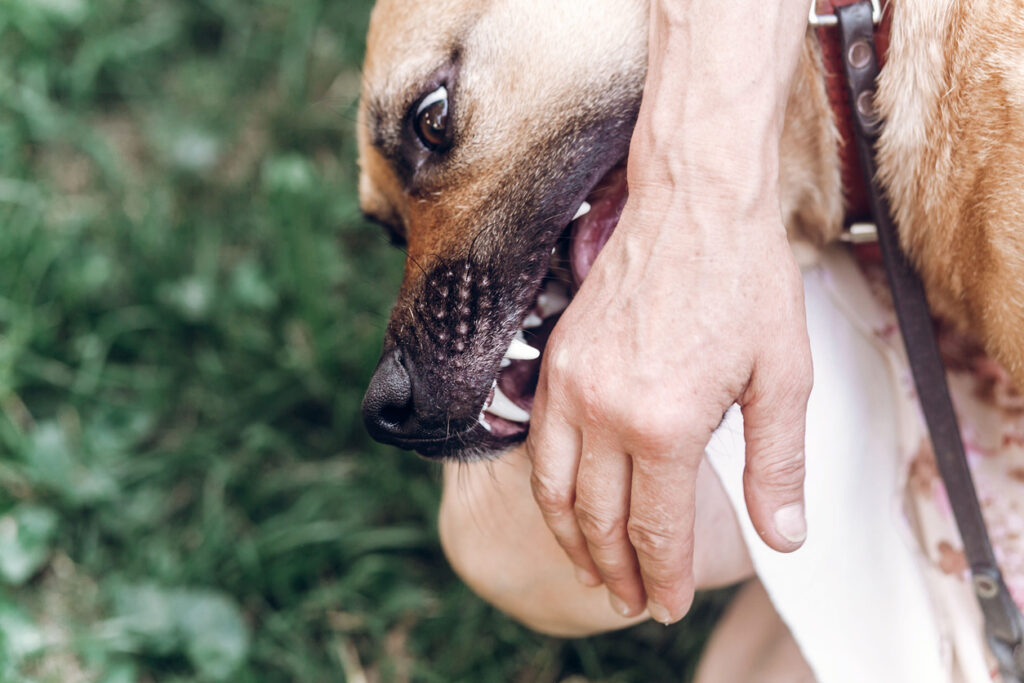 dog-biting-SC-residents-hand